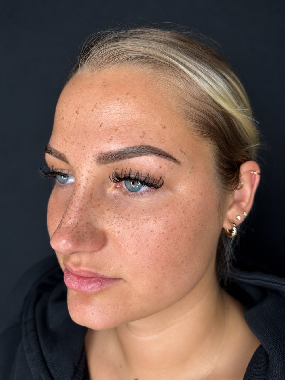 Permanent Freckles