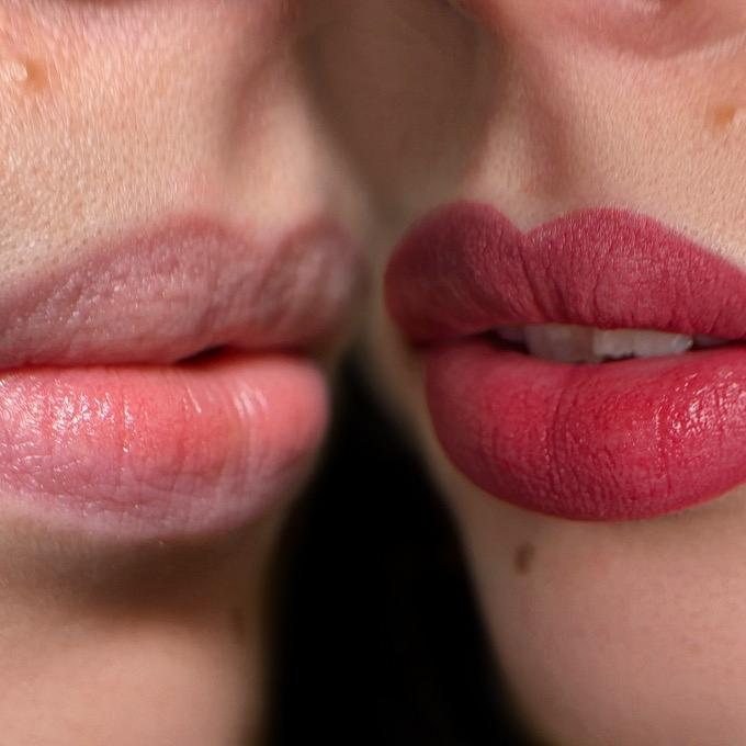 Lippen vorher und nachher